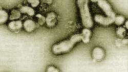 Influenza Aviaria - Virus H5N1